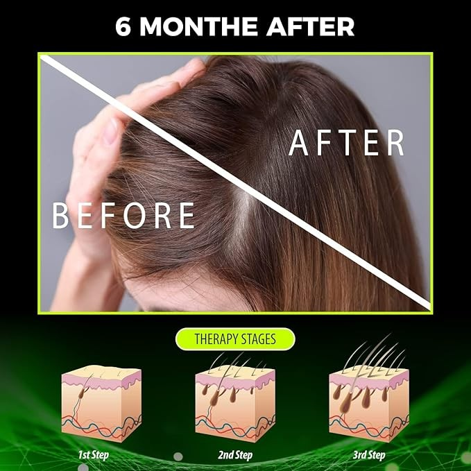 Vegan Anti-Hair Loss Therapy kit Shampoo and Conditioner, for Hair Growth and Thinning Hair - 10.44 fl.oz, Perola Negra Anti-Hair Loss Vegan Tonic, Reduce hair loss, Hair nourishing 4.05 fl.oz